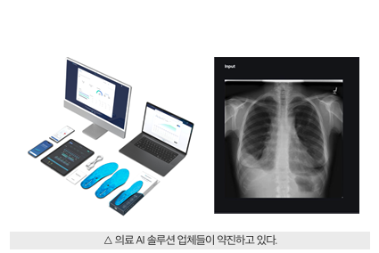 솔티드·숨빗AI 등 인공지능 솔루션으로 진단 새 기준 제시
